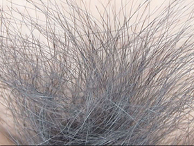 300人のまん毛3　サンプル画像12